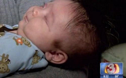 تولد نوزاد بدون چشم در آمریکا+عکس 
