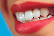 بهترین روش برای سفید کردن دندانها