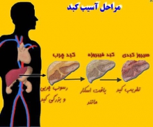  ۵ گیاه دارویی برای پاکسازی کبد