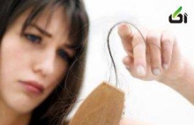 عوامل اصلی ریزش مو در زنان ایرانی 