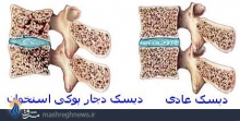 ویتامینی که از پوکی استخوان جلوگیری می کند