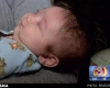 تولد نوزاد بدون چشم در آمریکا+عکس 
