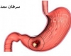  دلیل افزایش سرطان معده در ایران