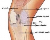 تعویض مفصل برای حذف درد زانو