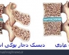 ویتامینی که از پوکی استخوان جلوگیری می کند